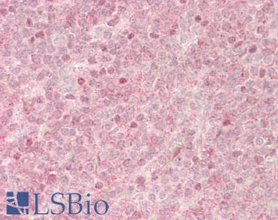 IHC-plus™ WAS / WASP Antibody