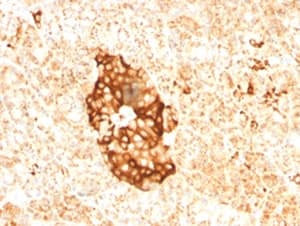 FTL / Ferritin Light Chain Antibody (clone FTLC1-1)