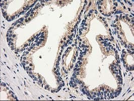CAT / Catalase Antibody (clone OTI1B8)