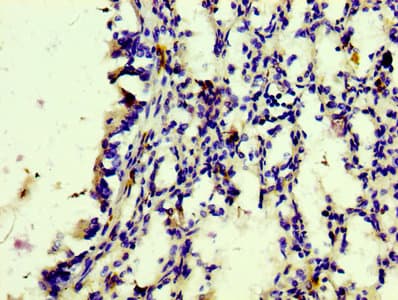 Recombinant Monoclonal Rabbit anti-Human CD163 Antibody (IHC)