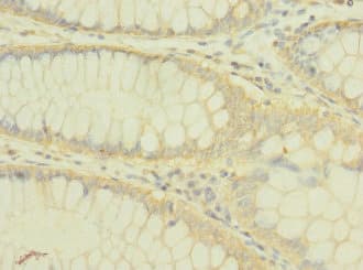 PLXNB2 / Plexin B2 Antibody
