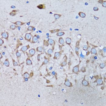 Polyclonal Rabbit anti-Human IRAK4 / IRAK-4 Antibody (IHC, WB)