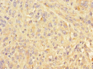 PELI3 / Pellino 3 Antibody
