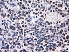 Monoclonal Mouse anti-Human ID3 Antibody (clone OTI12C7, IHC, IF, WB)