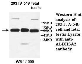 IHC-plus™ ALDH3A2 Antibody (aa166-400)