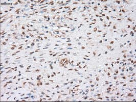 ACTN1 Antibody (clone OTI7A4)