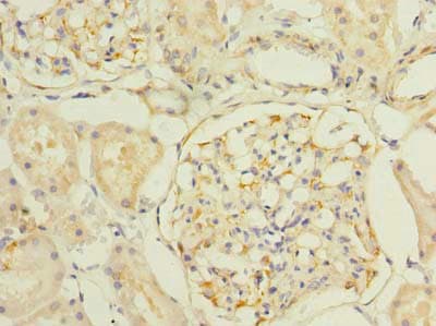 Polyclonal Rabbit anti-Human SLC25A33 Antibody (IHC)