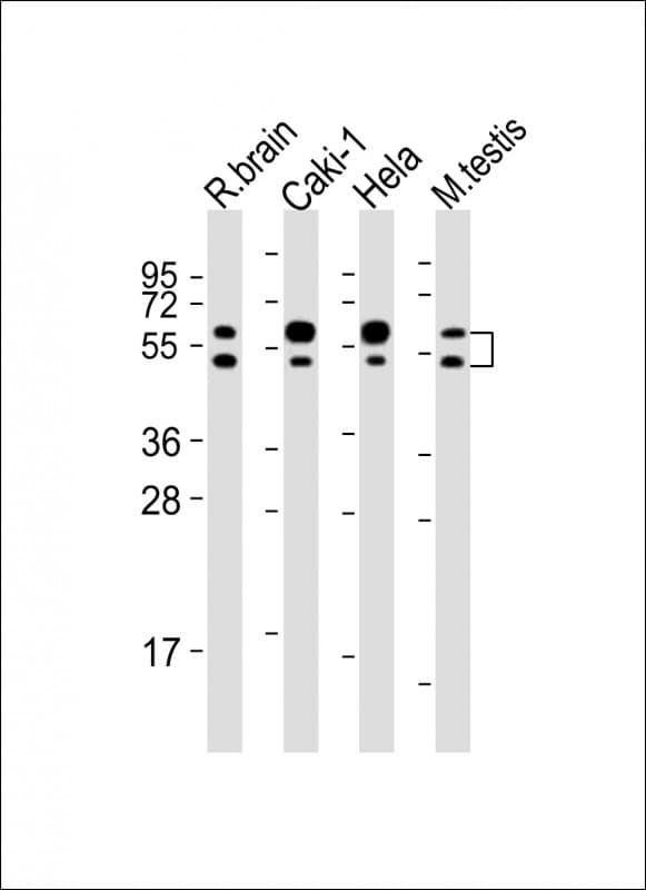 CDKL3 Antibody (aa2-34)