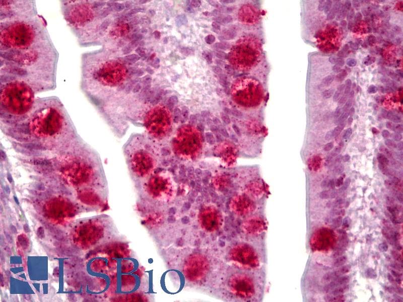 IHC-plus™ PTCH1 / Patched 1 Antibody (aa1-50)
