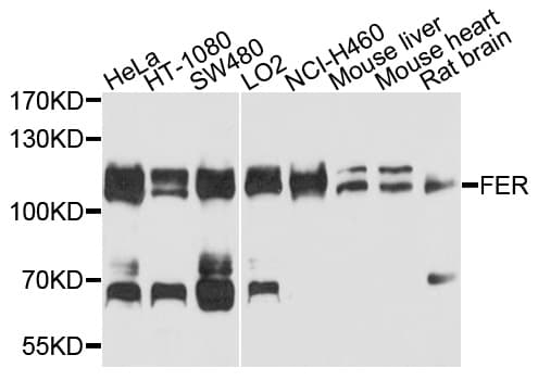IHC-plus™ Polyclonal Rabbit anti-Human FER Antibody (IHC, WB)