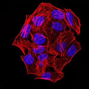 Monoclonal Mouse anti-Mouse IPAF / NLRC4 Antibody (clone 4B7B7, aa525-538, pSer533, IHC, WB)