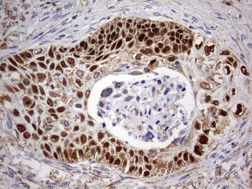 TP63 / p63 Antibody (clone OTI4E7)