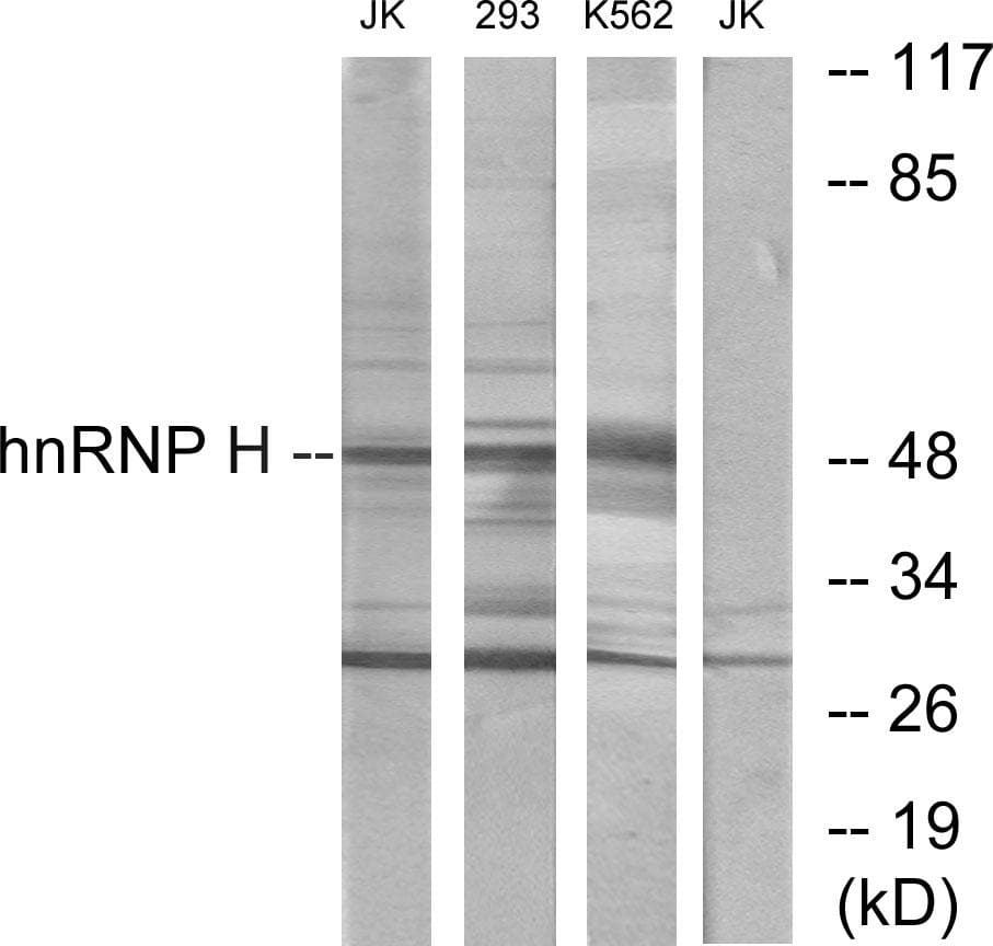 HNRNPH2 / hnRNP H2 Antibody
