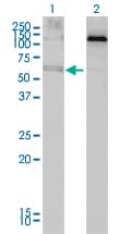 ALAS2 Antibody (clone 6C1)