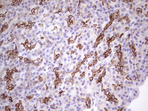 Monoclonal Mouse anti-Human Acidic Cytokeratin AE1 Antibody (clone AE1, IHC)