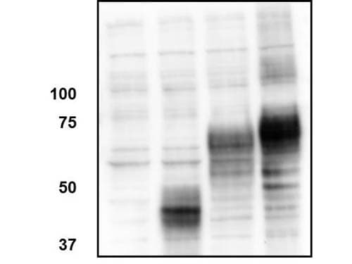 TMEM142A / ORAI1 Antibody