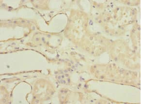 Polyclonal Rabbit anti-Human MGLL / Monoacylglycerol Lipase Antibody (IHC)