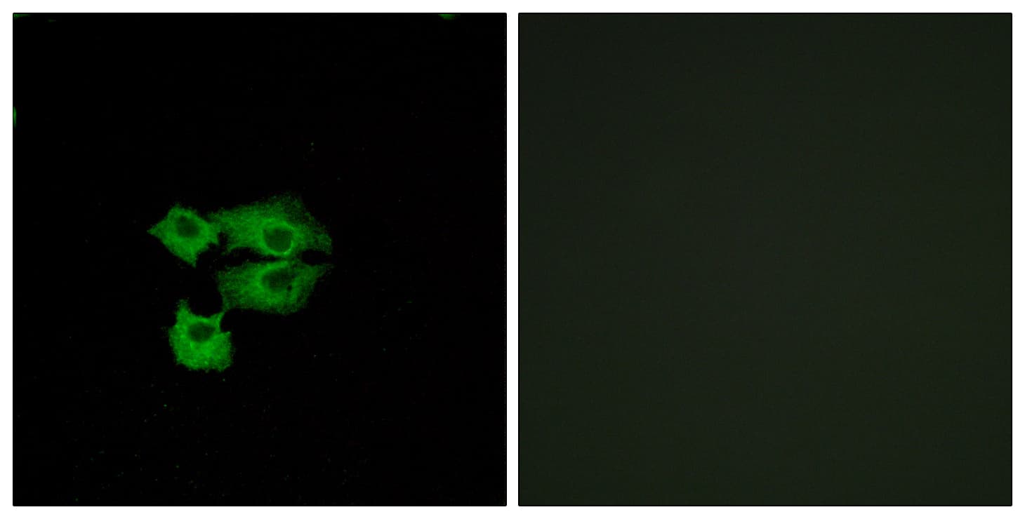 IHC-plus™ SCA2 / LY6E Antibody (aa17-66)