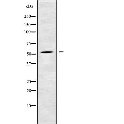 CYP2C9 / Cytochrome P450 2C9 Antibody
