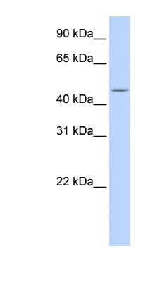 CPE / Carboxypeptidase E Antibody (aa36-85)