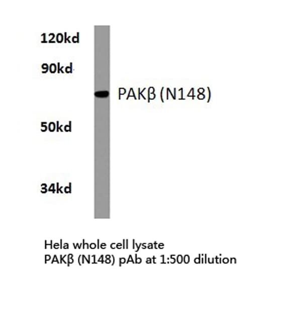 PAK3 Antibody (Asn148)