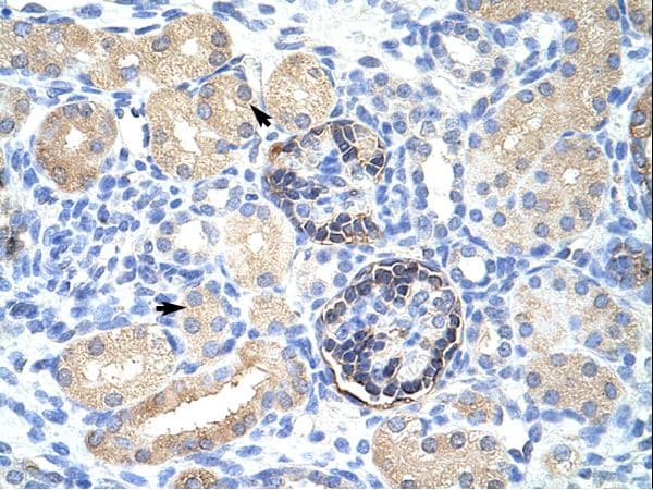 CLIC5 Antibody (C-Terminus)
