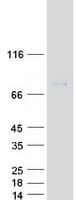 Human FMR1 / FMRP Protein (Recombinant Myc-DDK (Flag))