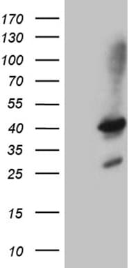 SHARPIN Antibody (aa1-326, clone OTI1F4, Carrier-free)