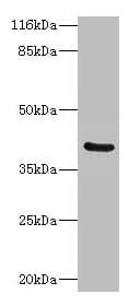 CA12 / Carbonic Anhydrase XII Antibody (aa25-301)