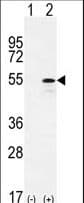 CYP26B1 Antibody (aa398-430)