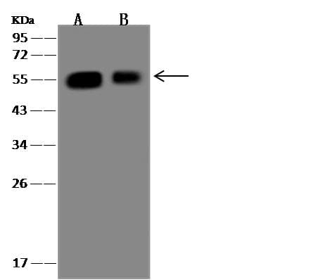 Polyclonal Rabbit anti-Human TUBA1A / Tubulin Alpha 1a Antibody (Preservative Free, IHC, IF, WB)