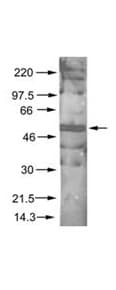 IHC-plus™ AKT1 + AKT2 + AKT3 Antibody (phospho-Ser473)