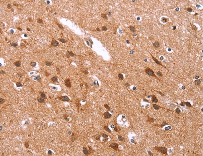 GLMN Antibody