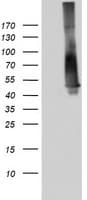 TP53 / p53 Antibody (clone OTI9A7)