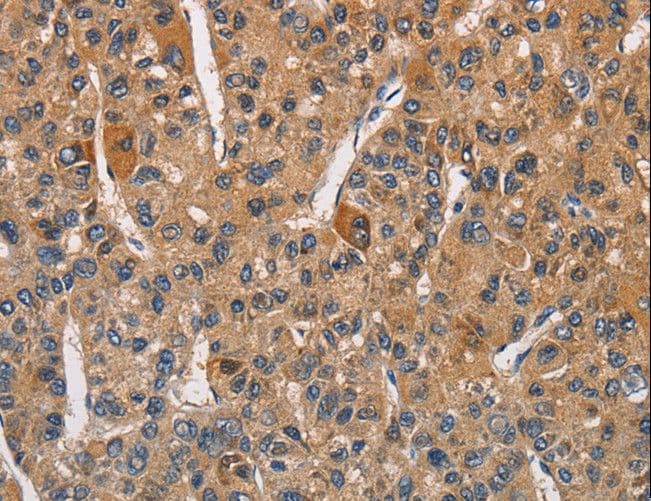 RICTOR Antibody