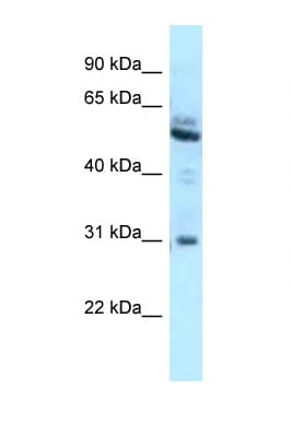 LRMP / JAW1 Antibody (aa354-403)