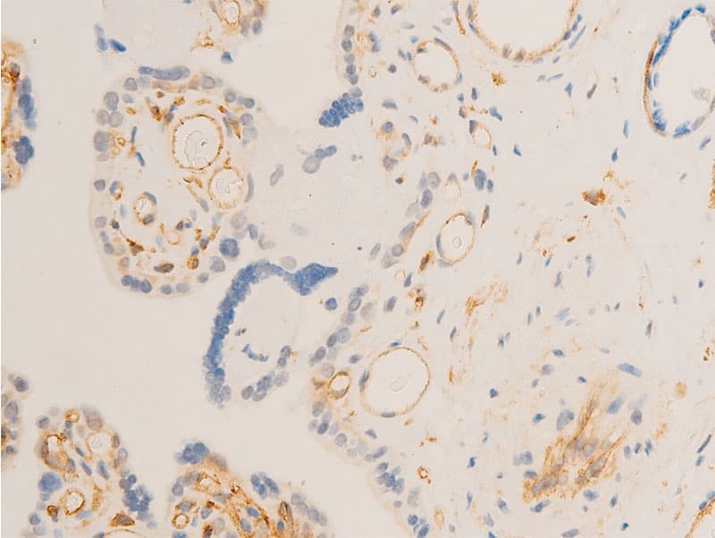 Polyclonal Rabbit anti-Human SYK Antibody (phospho-Tyr323, IHC, IF, WB)