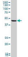 PGA5 / Pepsin A Antibody (clone 4G9)