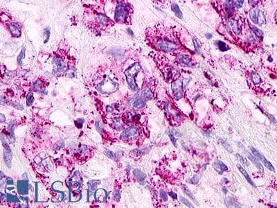 PathPlus™ GPR12 Antibody (Extracellular Domain)
