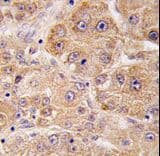 UVRAG Antibody (aa666-699)