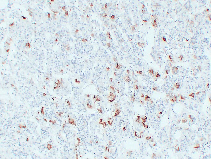 TSHB / TSH-Beta Antibody (clone ABT-TSH)