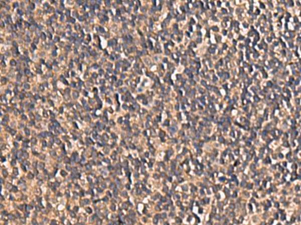 Polyclonal Rabbit anti-Human PLEKHF2 Antibody (IHC, WB)