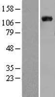 VCL / Vinculin Protein (Over-Expression Lysate Myc-DDK (Flag))