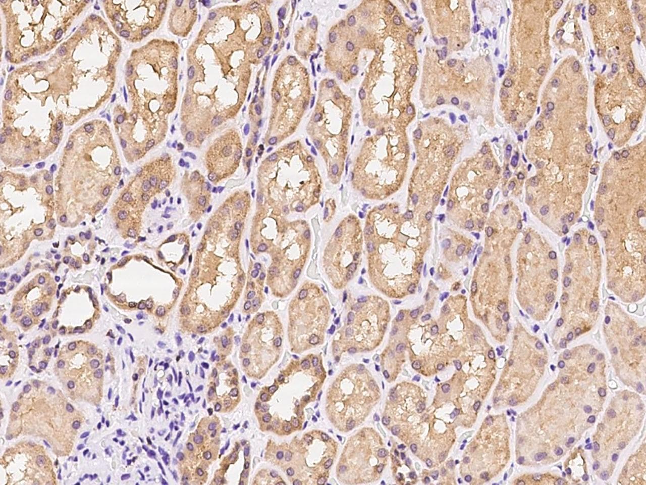 Polyclonal Rabbit anti-Human ANAPC13 Antibody (IHC)