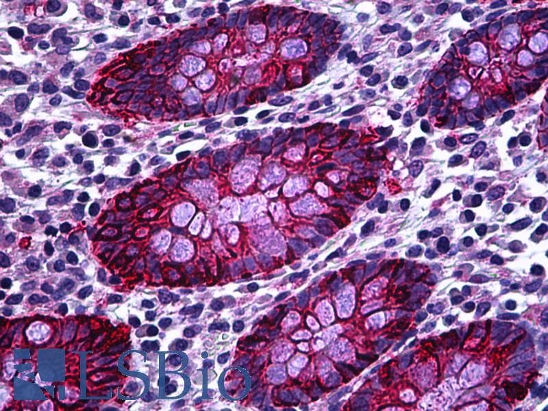IHC-plus™ EPCAM Antibody (clone AUA1)