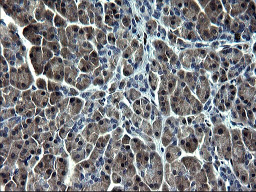 Monoclonal Mouse anti-Human SMAD1 Antibody (clone OTI1C5, IHC, WB)