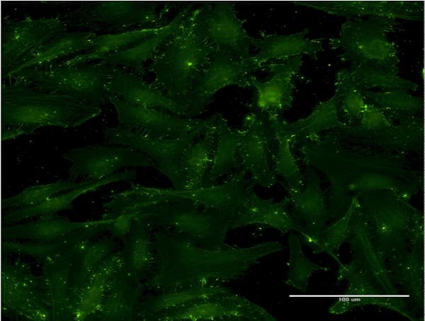 CD9 Antibody (clone 4A2)