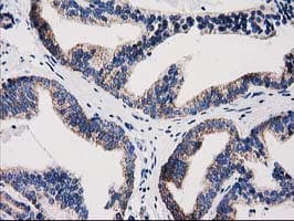 GRHPR / Glyoxylate Reductase Antibody (clone OTI10A3)