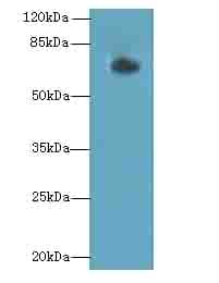 Polyclonal Rabbit anti-Human GNL1 Antibody (WB)