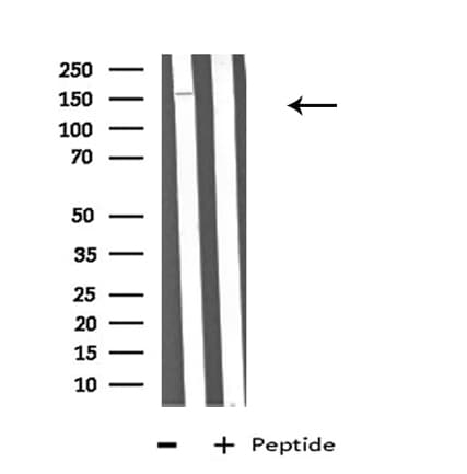 ABCA6 Antibody